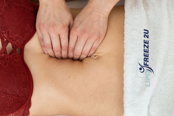 diastasis recti treatment Sevenoaks