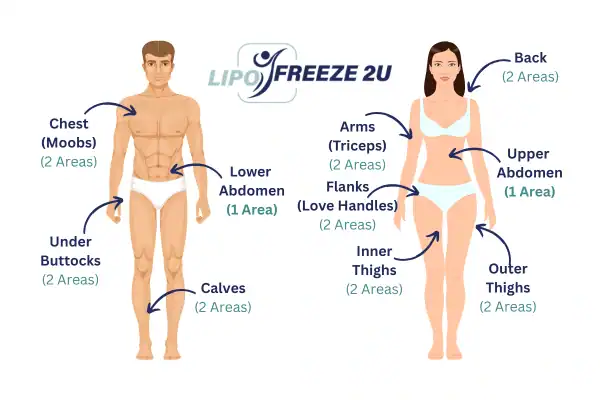 Areas you can have fat freezing treatment Sevenoaks