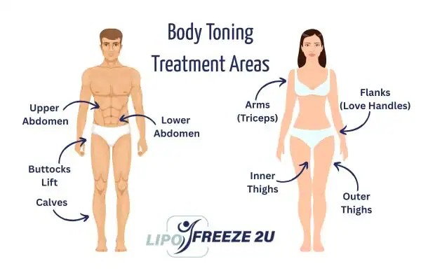 Graphic showing where you can have Body toning Treatment Sevenoaks on your body