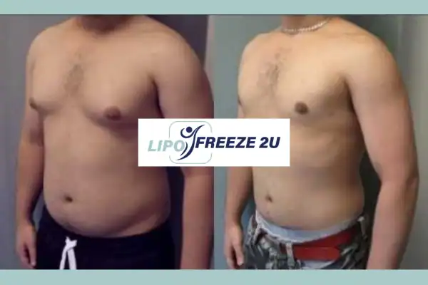 How Long Does It Take to See Results Sevenoaks?