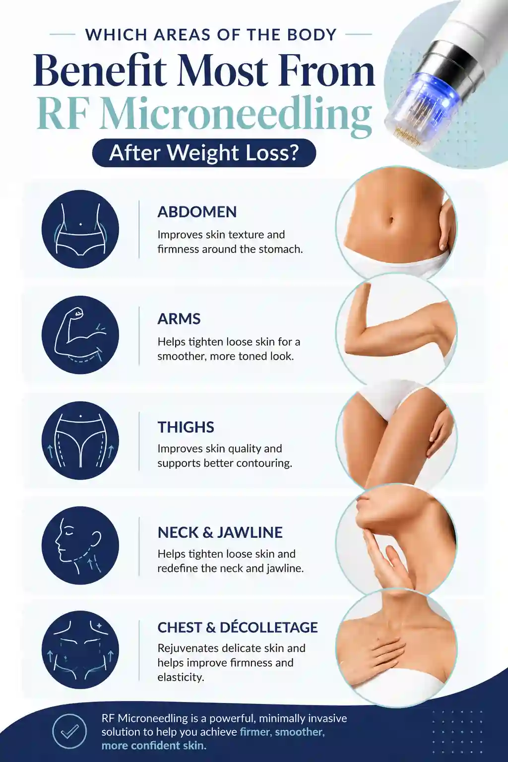 Which Areas of the Body Benefit Most From RF Microneedling After Weight Loss Sevenoaks
